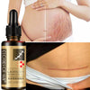 Essential Massage Oil Scar Removal Lavender Repair Essence For Pregnant Women Hyaluronic Acid Serum Oil Essential Face Anti Acne