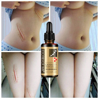 Essential Massage Oil Scar Removal Lavender Repair Essence For Pregnant Women Hyaluronic Acid Serum Oil Essential Face Anti Acne
